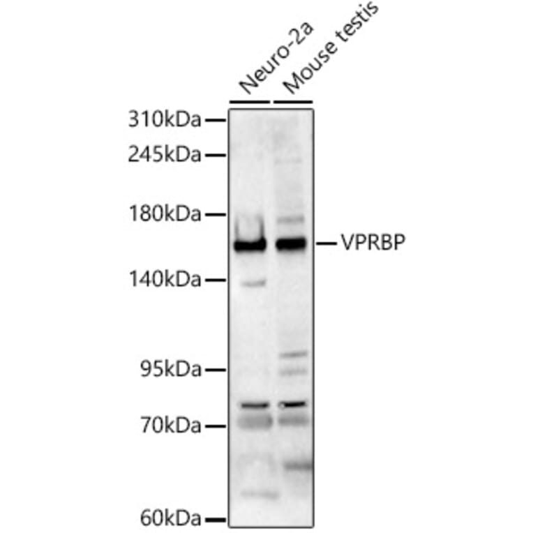 Western Blot - Anti-VPRBP Antibody (A329962) - Antibodies.com
