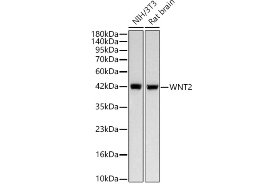 Western Blot - Anti-Wnt2 Antibody [ARC58485] (A329963) - Antibodies.com