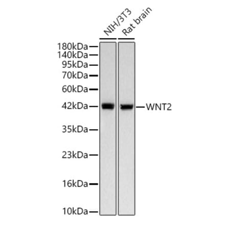 Western Blot - Anti-Wnt2 Antibody [ARC58485] (A329963) - Antibodies.com