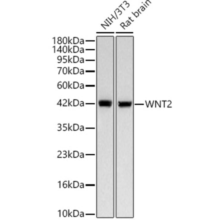Western Blot - Anti-Wnt2 Antibody [ARC58485] (A329963) - Antibodies.com