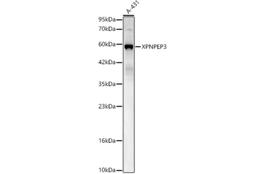 Western Blot - Anti-XPNPEP3 Antibody (A329965) - Antibodies.com
