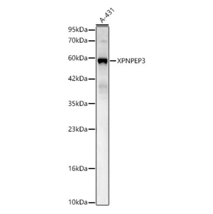 Western Blot - Anti-XPNPEP3 Antibody (A329965) - Antibodies.com