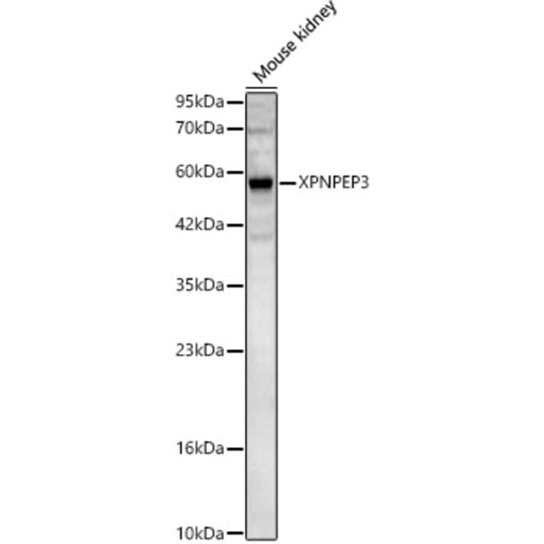 Western Blot - Anti-XPNPEP3 Antibody (A329965) - Antibodies.com