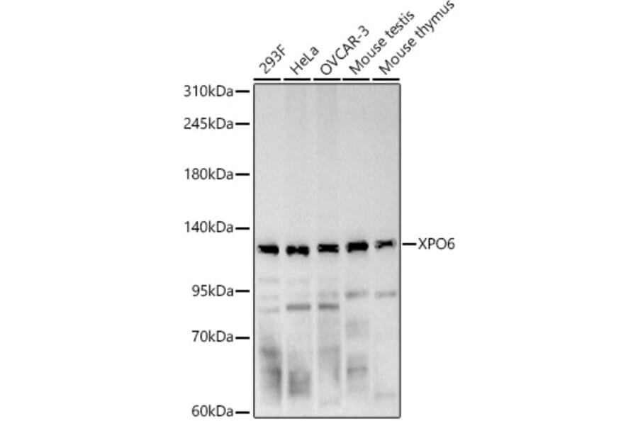 Western Blot - Anti-XPO6 Antibody (A329966) - Antibodies.com