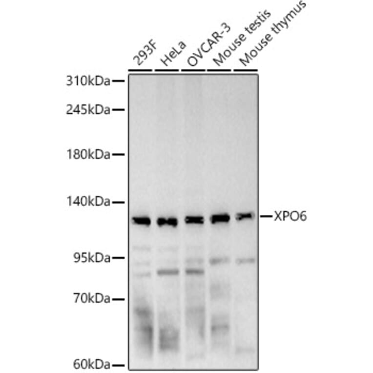Western Blot - Anti-XPO6 Antibody (A329966) - Antibodies.com