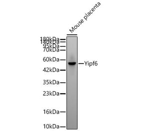 Western Blot - Anti-Yipf6 Antibody (A329968) - Antibodies.com