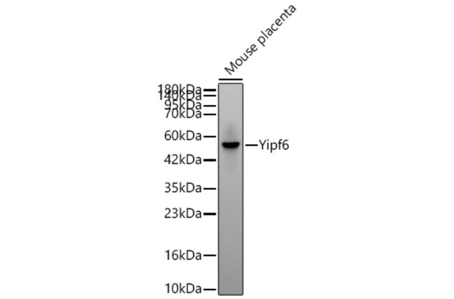 Western Blot - Anti-Yipf6 Antibody (A329968) - Antibodies.com