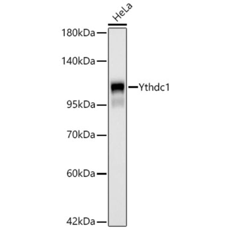 Western Blot - Anti-YTHDC1 Antibody [ARC66394] (A329970) - Antibodies.com