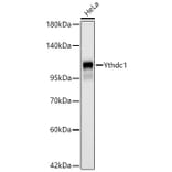 Western Blot - Anti-YTHDC1 Antibody [ARC66394] (A329970) - Antibodies.com