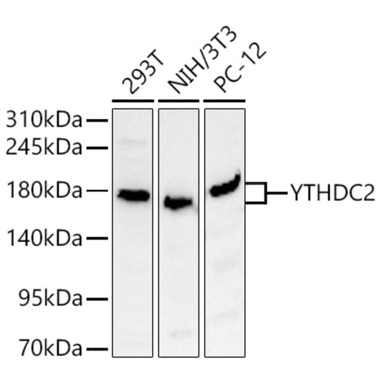 Western Blot - Anti-YTHDC2 Antibody (A329971) - Antibodies.com