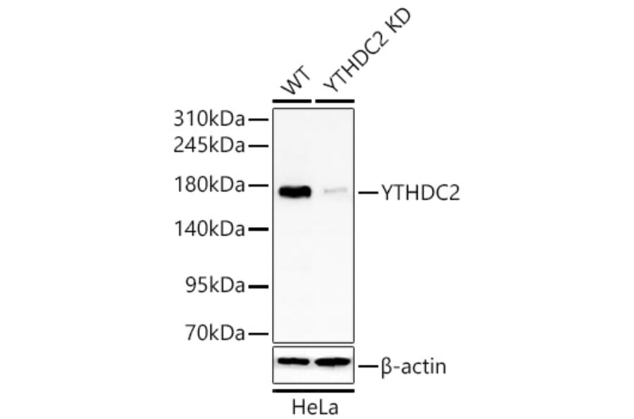 Western Blot - Anti-YTHDC2 Antibody (A329971) - Antibodies.com