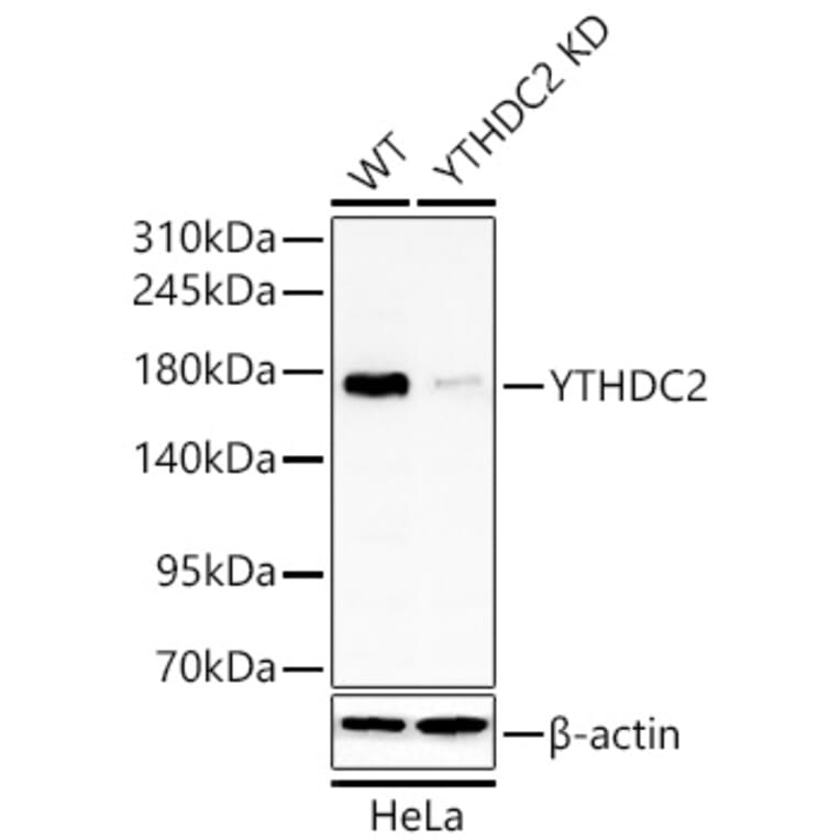 Western Blot - Anti-YTHDC2 Antibody (A329971) - Antibodies.com