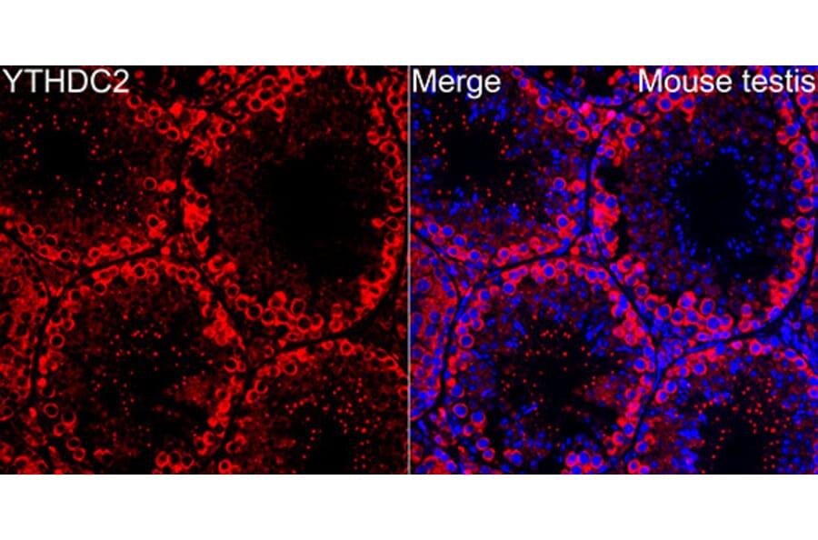 Immunofluorescence - Anti-YTHDC2 Antibody (A329971) - Antibodies.com