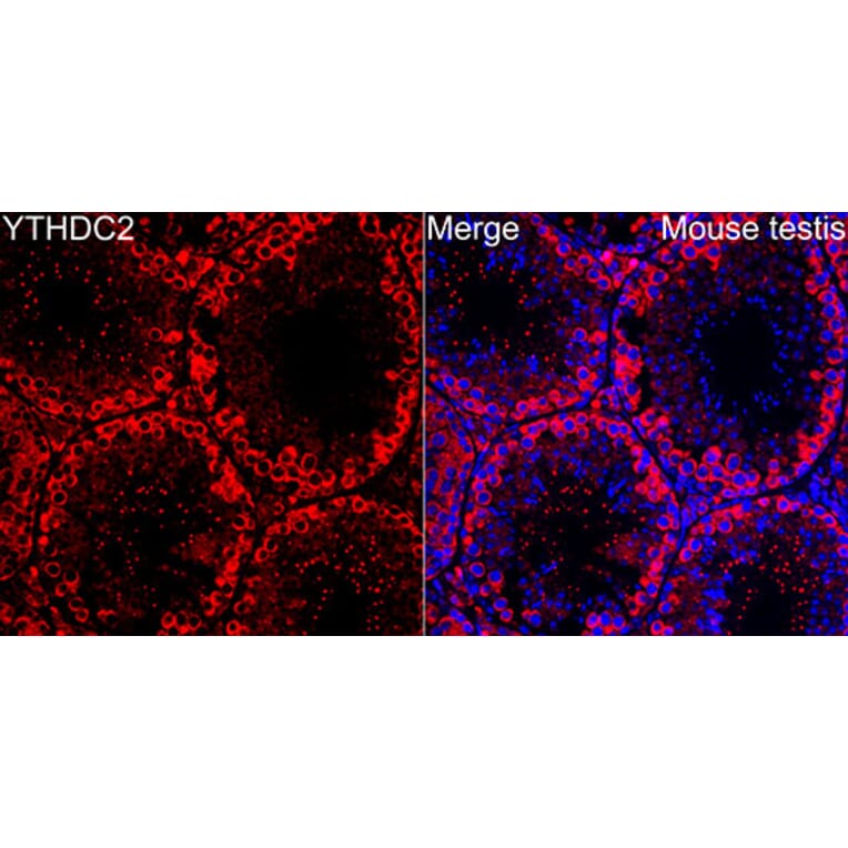 Immunofluorescence - Anti-YTHDC2 Antibody (A329971) - Antibodies.com
