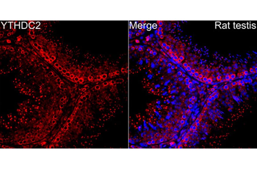 Immunofluorescence - Anti-YTHDC2 Antibody (A329971) - Antibodies.com