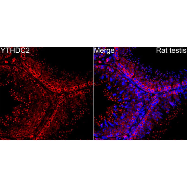 Immunofluorescence - Anti-YTHDC2 Antibody (A329971) - Antibodies.com
