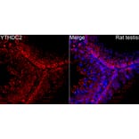 Immunofluorescence - Anti-YTHDC2 Antibody (A329971) - Antibodies.com