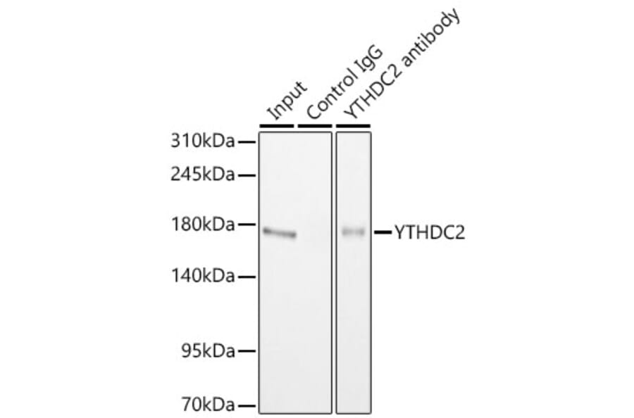 Western Blot - Anti-YTHDC2 Antibody (A329971) - Antibodies.com