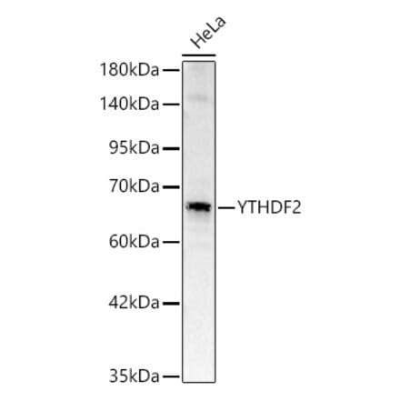Western Blot - Anti-YTHDF2 Antibody (A329972) - Antibodies.com