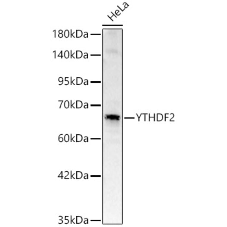 Western Blot - Anti-YTHDF2 Antibody (A329972) - Antibodies.com