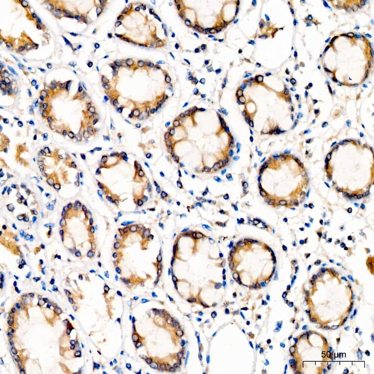 Immunohistochemistry - Anti-YTHDF2 Antibody (A329972) - Antibodies.com