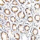 Immunohistochemistry - Anti-YTHDF2 Antibody (A329972) - Antibodies.com