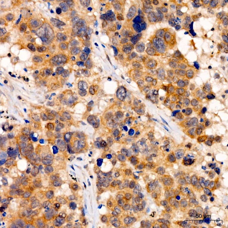 Immunohistochemistry - Anti-YTHDF2 Antibody (A329972) - Antibodies.com