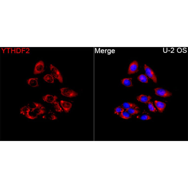 Immunofluorescence - Anti-YTHDF2 Antibody (A329972) - Antibodies.com