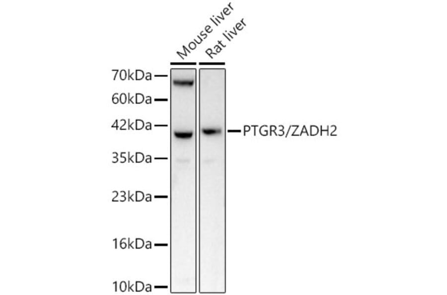 Western Blot - Anti-ZADH2 Antibody (A329973) - Antibodies.com