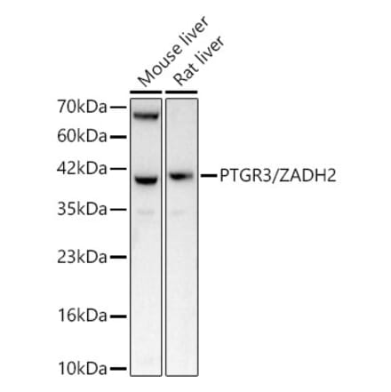 Western Blot - Anti-ZADH2 Antibody (A329973) - Antibodies.com