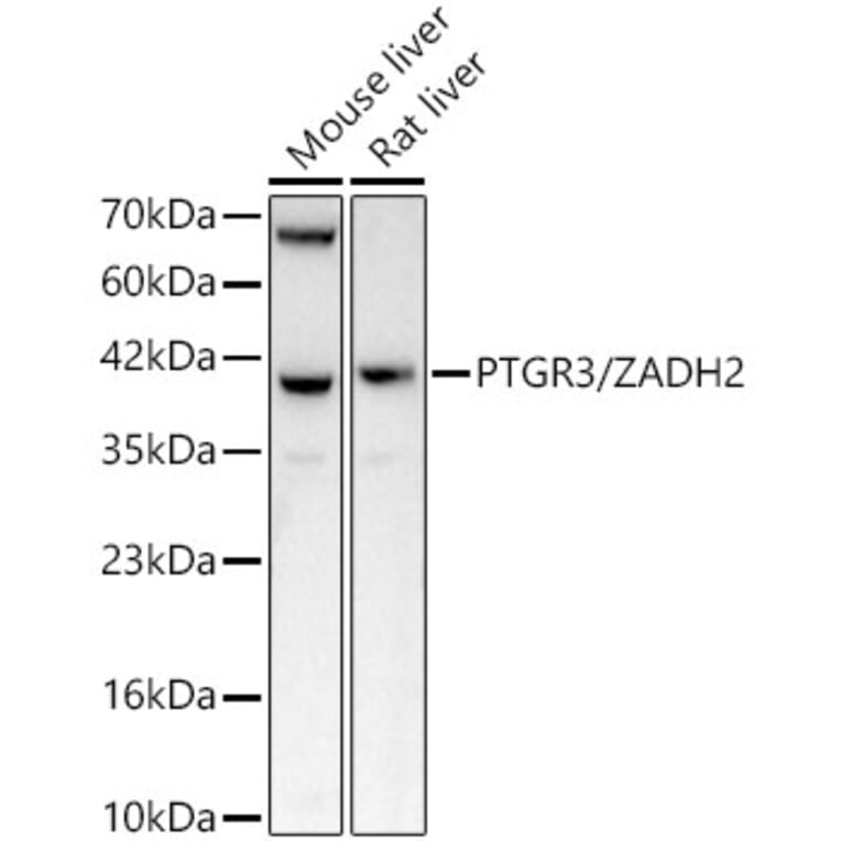 Western Blot - Anti-ZADH2 Antibody (A329973) - Antibodies.com