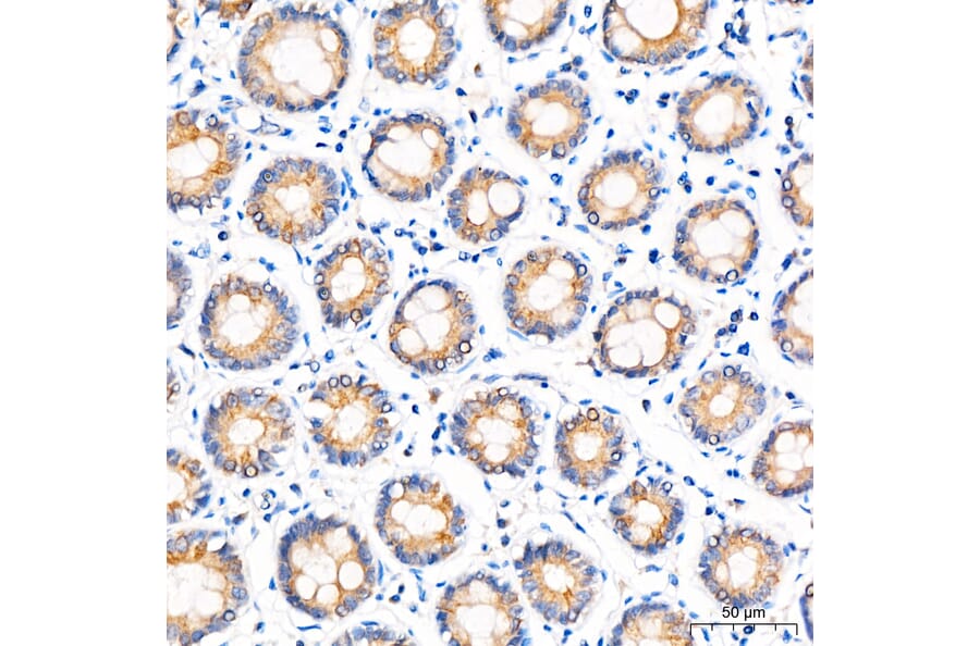 Immunohistochemistry - Anti-ZADH2 Antibody (A329973) - Antibodies.com