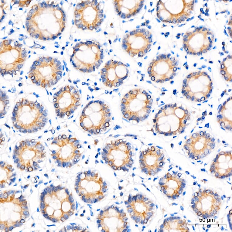 Immunohistochemistry - Anti-ZADH2 Antibody (A329973) - Antibodies.com