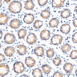 Immunohistochemistry - Anti-ZADH2 Antibody (A329973) - Antibodies.com