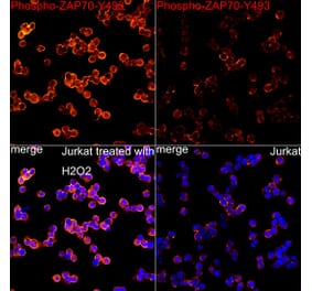 Immunofluorescence - Anti-ZAP70 (Phospho Y493) Antibody (A329974) - Antibodies.com