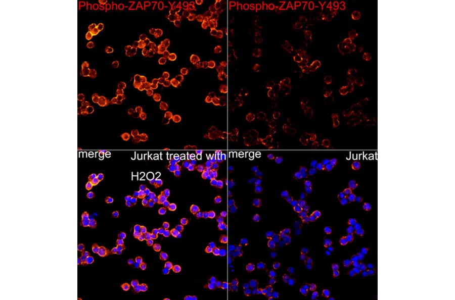 Immunofluorescence - Anti-ZAP70 (Phospho Y493) Antibody [ARC59392] (A329974) - Antibodies.com
