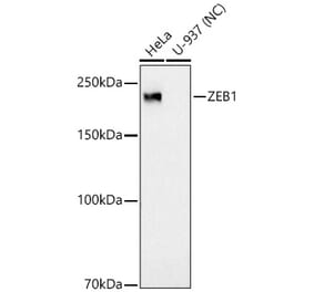 Western Blot - Anti-ZEB1 Antibody [ARC53604] (A329975) - Antibodies.com