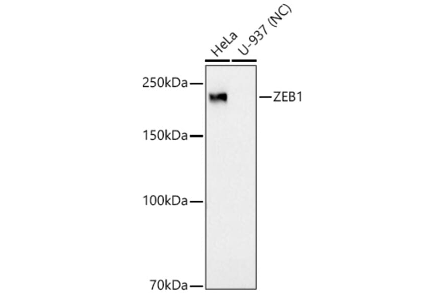 Western Blot - Anti-ZEB1 Antibody [ARC53604] (A329975) - Antibodies.com