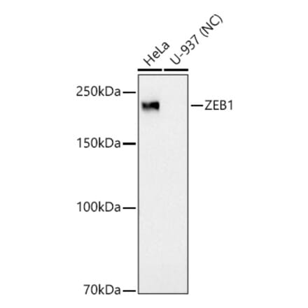 Western Blot - Anti-ZEB1 Antibody [ARC53604] (A329975) - Antibodies.com