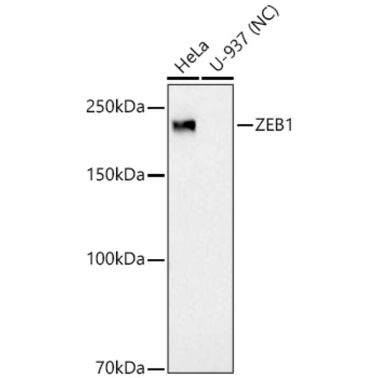 Western Blot - Anti-ZEB1 Antibody [ARC53604] (A329975) - Antibodies.com