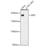 Western Blot - Anti-ZEB1 Antibody [ARC53604] (A329975) - Antibodies.com