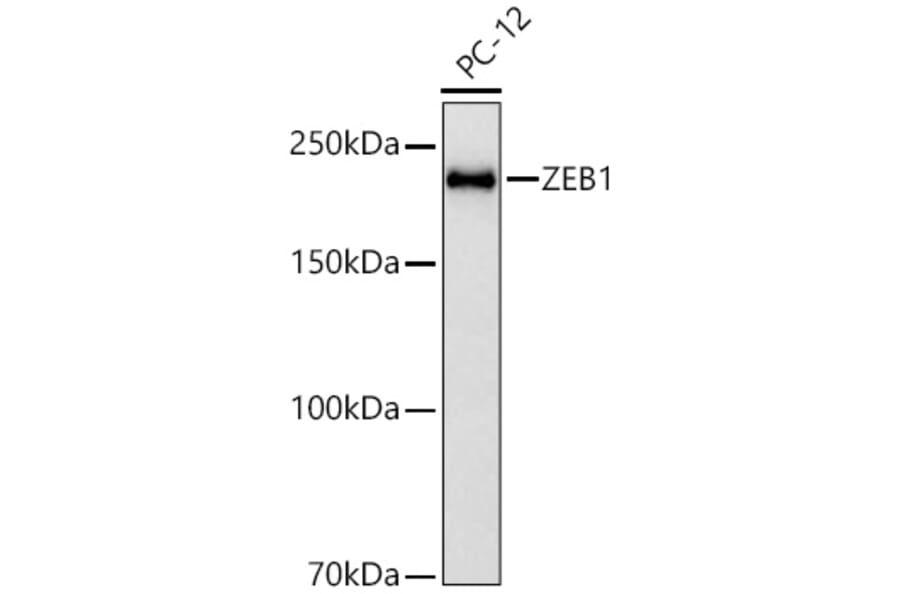 Western Blot - Anti-ZEB1 Antibody [ARC53604] (A329975) - Antibodies.com