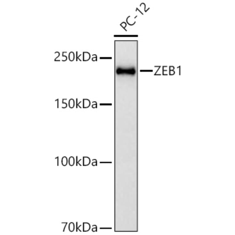 Western Blot - Anti-ZEB1 Antibody [ARC53604] (A329975) - Antibodies.com