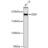 Western Blot - Anti-ZEB1 Antibody [ARC53604] (A329975) - Antibodies.com