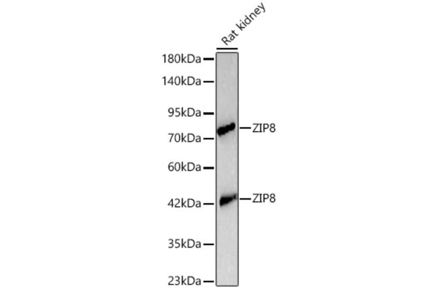 Western Blot - Anti-ZIP8 Antibody (A329978) - Antibodies.com
