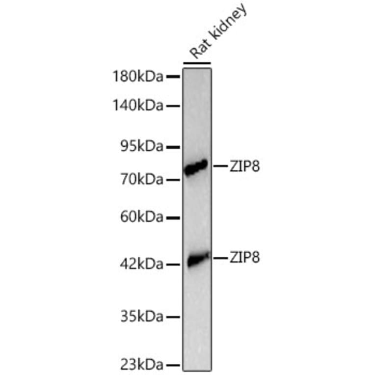 Western Blot - Anti-ZIP8 Antibody (A329978) - Antibodies.com