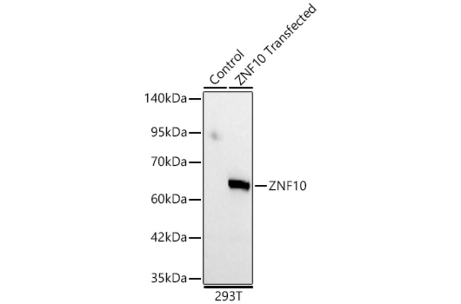 Western Blot - Anti-ZNF10 Antibody (A329979) - Antibodies.com