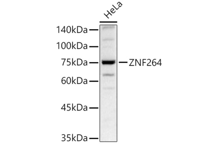 Western Blot - Anti-ZNF264 Antibody (A329980) - Antibodies.com