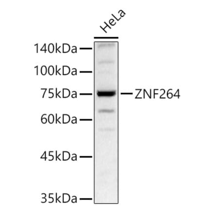 Western Blot - Anti-ZNF264 Antibody (A329980) - Antibodies.com