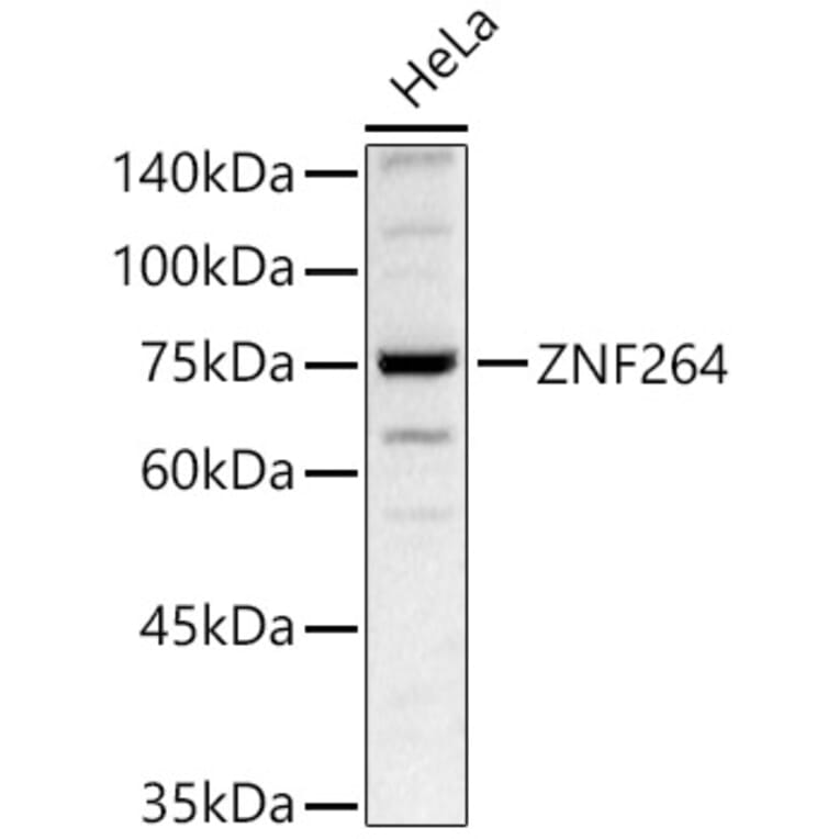 Western Blot - Anti-ZNF264 Antibody (A329980) - Antibodies.com